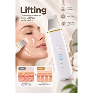 CONCORD SM-15 RENORA 4IN1 Ultrasonic Cilt Temizleme Spatulası